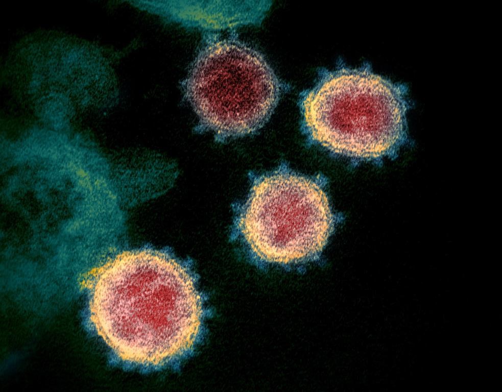 Ontario likely in new COVID wave driven by BA.5 subvariant, science table says