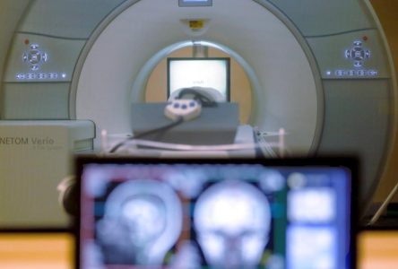 Ontario invests $20M in operating costs for new MRI machines