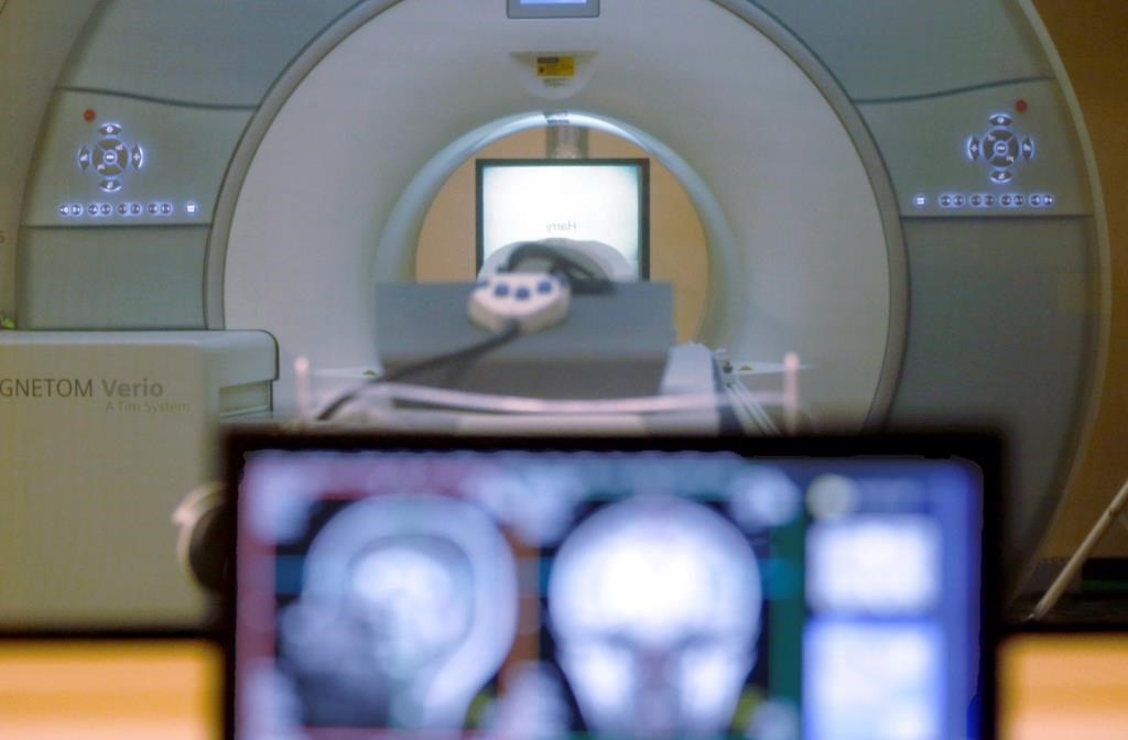 Ontario invests $20M in operating costs for new MRI machines