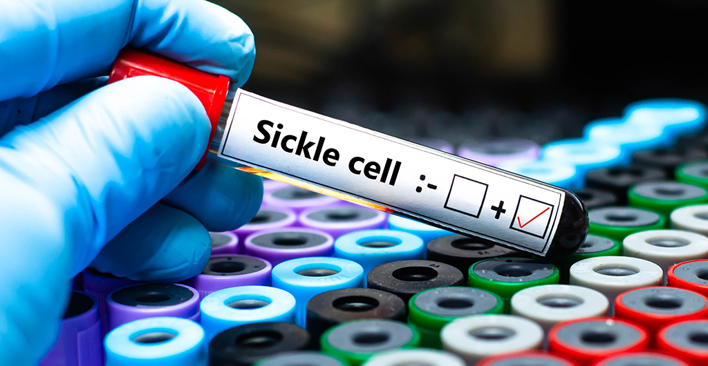 World Sickle Cell Day